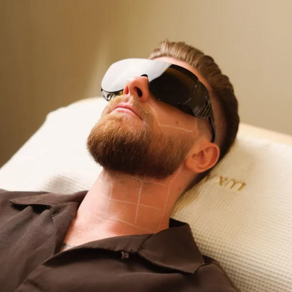 Beard Laser Hair Removal G12