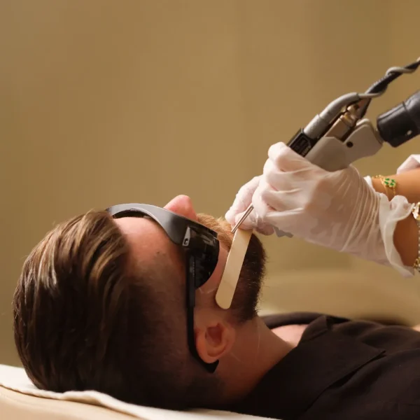 Beard Laser Hair Removal G1