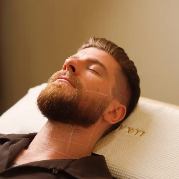 Beard Laser Hair Removal G9