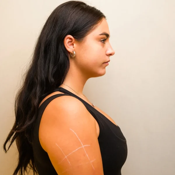 Body Contouring G32