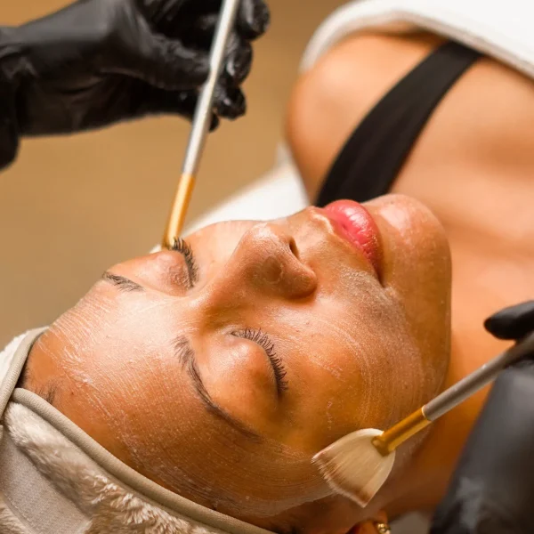 chemical peel G11