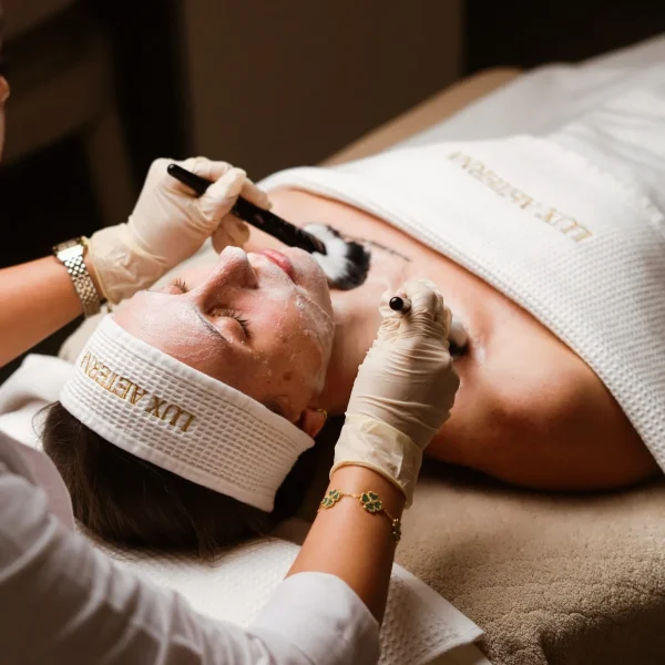 chemical peel G14