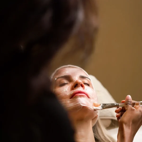 chemical peel G4