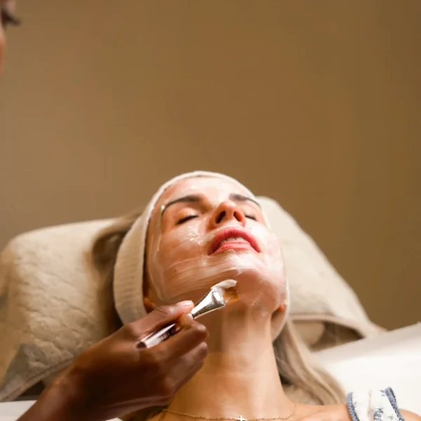 chemical peel G5