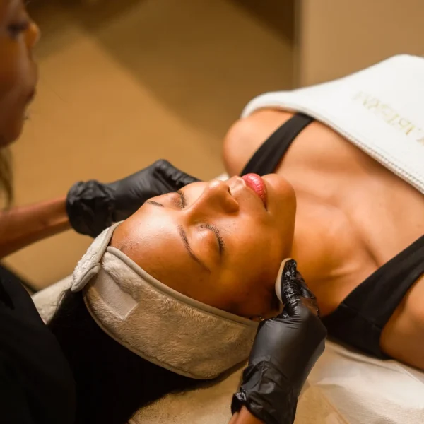 chemical peel G9
