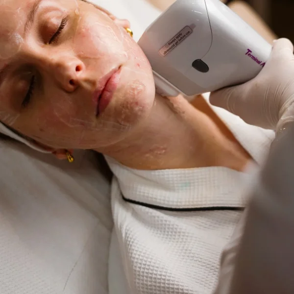 HIFU treatment G2