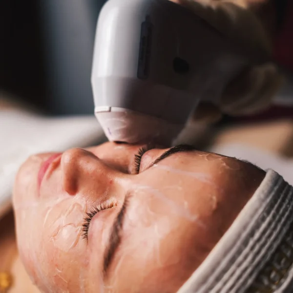 HIFU treatment G20