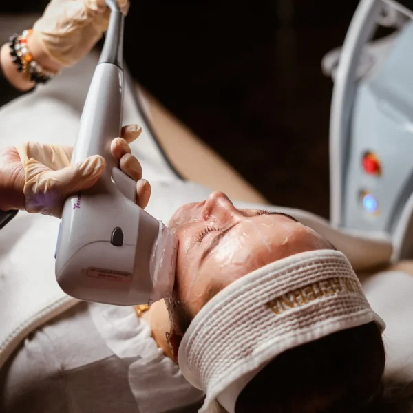 HIFU treatment G2