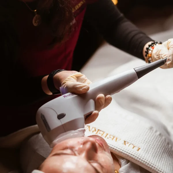 HIFU treatment G25