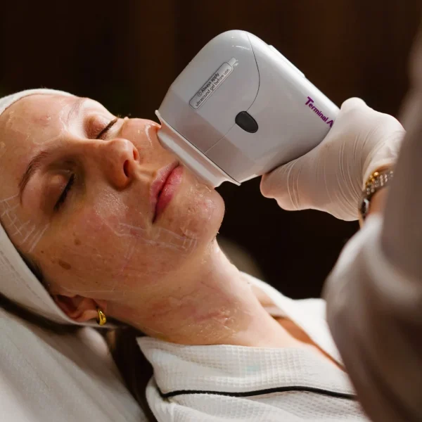 HIFU treatment G3