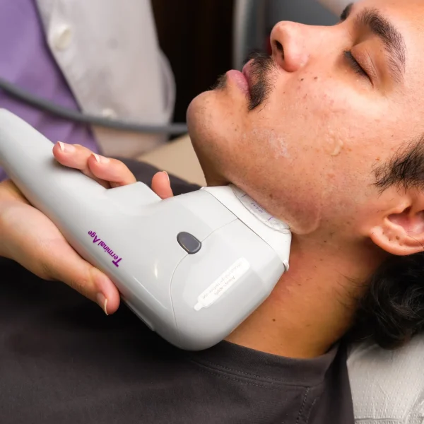 laser hair removal G1