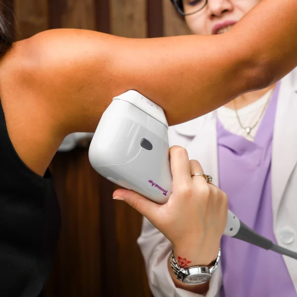 laser hair removal G10
