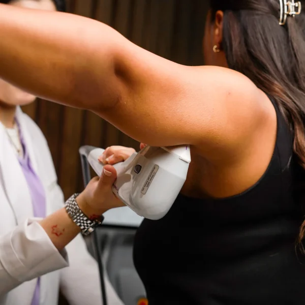 laser hair removal G12