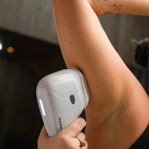 laser hair removal G2