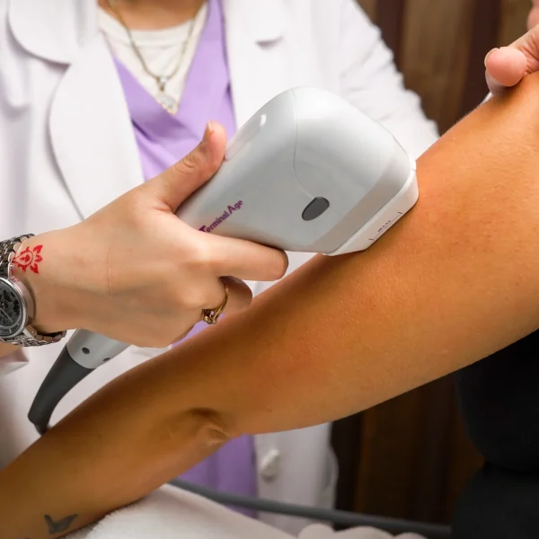 laser hair removal G6