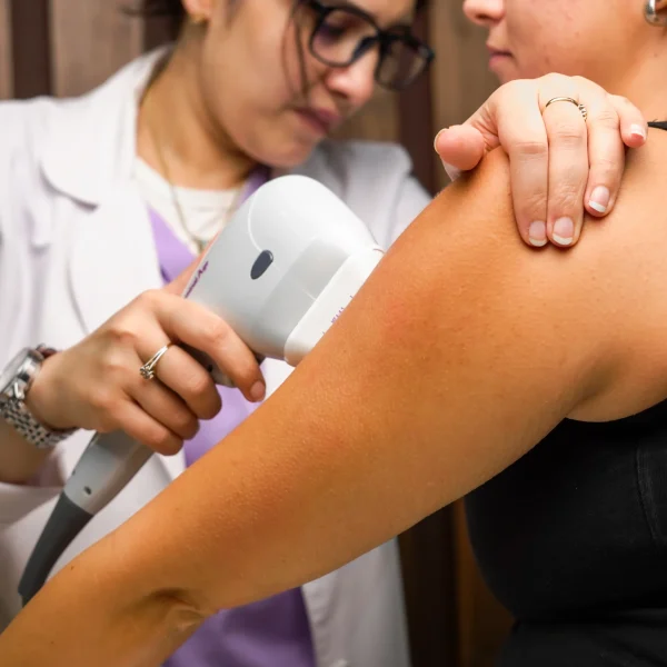 laser hair removal G7